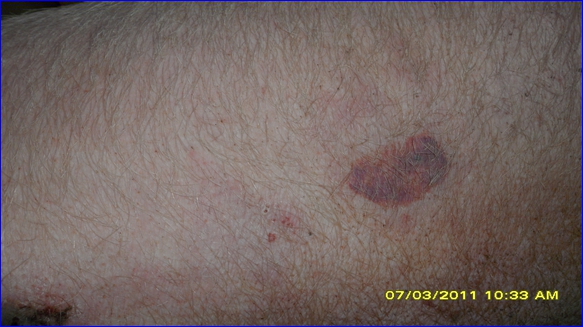 ù������