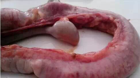 壞死性腸炎感染