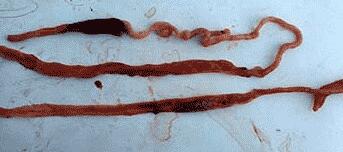 ��ĩ����Fˎ�S�ҽ��h���u���x��Ҫ�ƌW��������